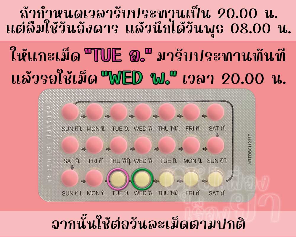 ลืมใช้ จีเว็กซ่า 1 วัน แล้วนึกได้ก่อนถึงเวลารับประทานยาคุมประจำวัน