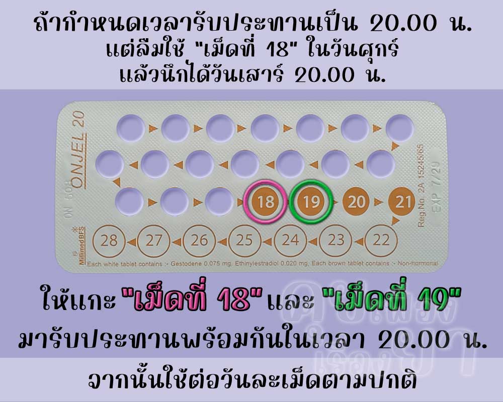 ลืมใช้เม็ดฮอร์โมนของ ออนเจล 20 นาน 1 วัน แล้วนึกได้เมื่อถึงเวลารับประทานยาคุมประจำวัน
