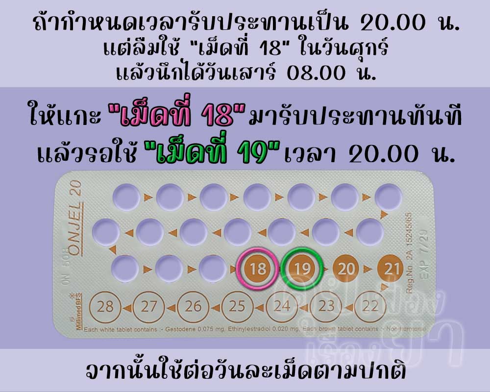 ลืมใช้เม็ดฮอร์โมนของ ออนเจล 20 นาน 1 วัน แล้วนึกได้ก่อนถึงเวลารับประทานยาคุมประจำวัน
