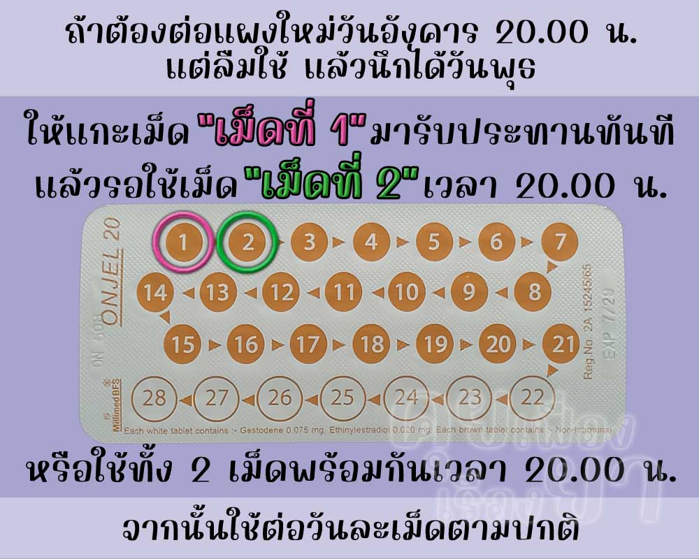 ลืมต่อแผงใหม่ยาคุม ออนเจล 20 นาน 1 วัน