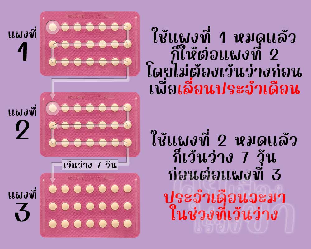 เลื่อนประจำเดือนด้วยยาคุมแบบ 21 เม็ด