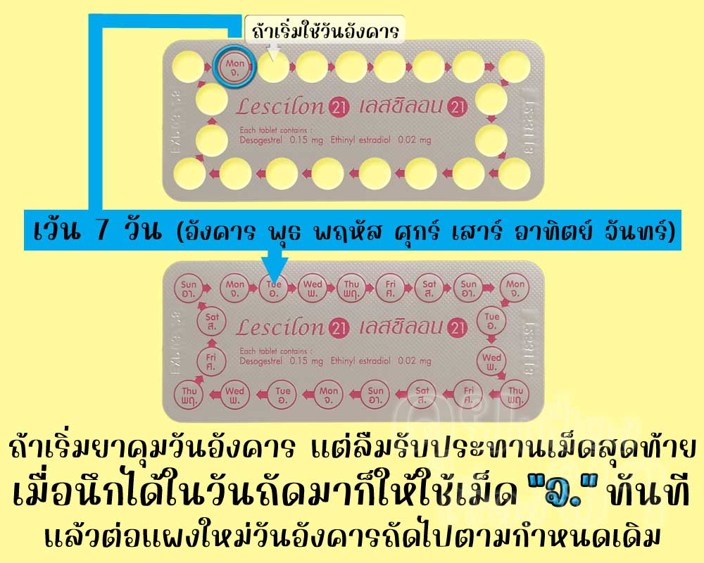 ลืมใช้ยาคุมเม็ดสุดท้ายในแผงของ เลสซิลอน 21