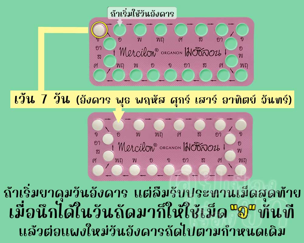 ลืมใช้ยาคุมเม็ดสุดท้ายในแผงของ เมอซิลอน