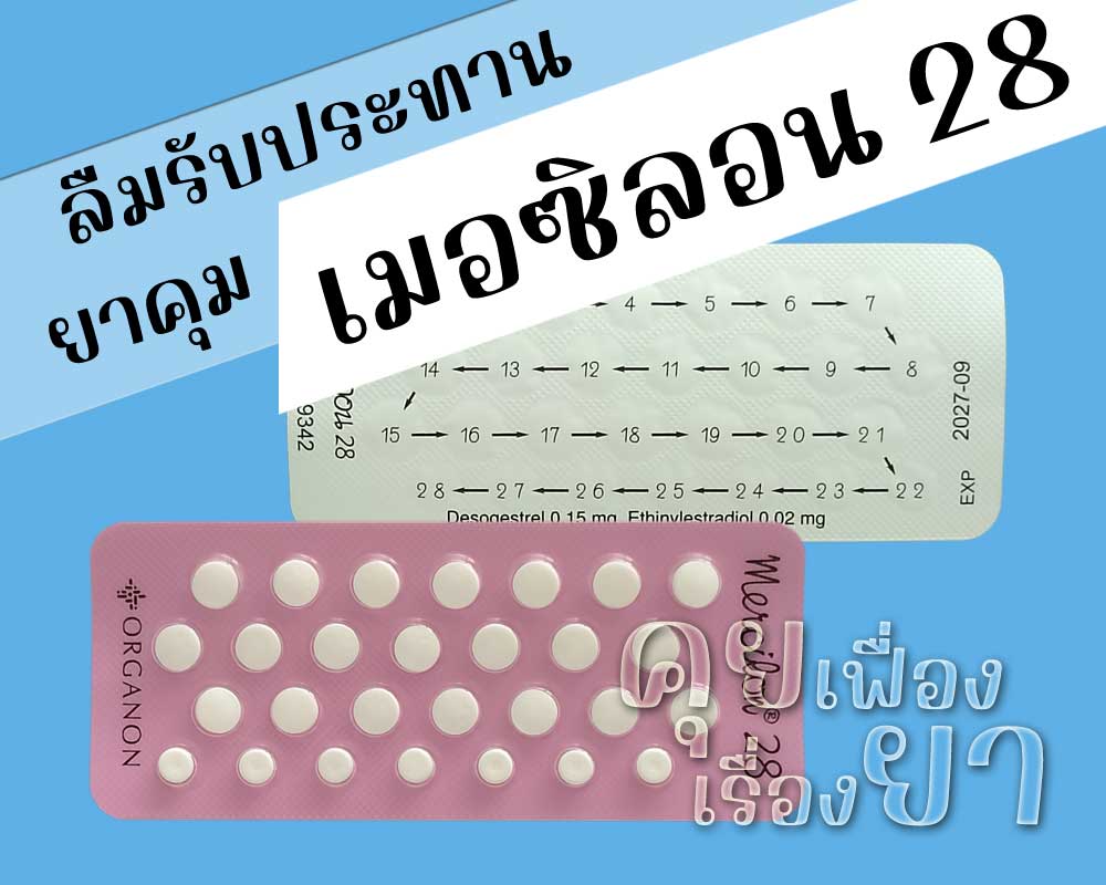 ลืมรับประทานยาคุม เมอซิลอน 28
