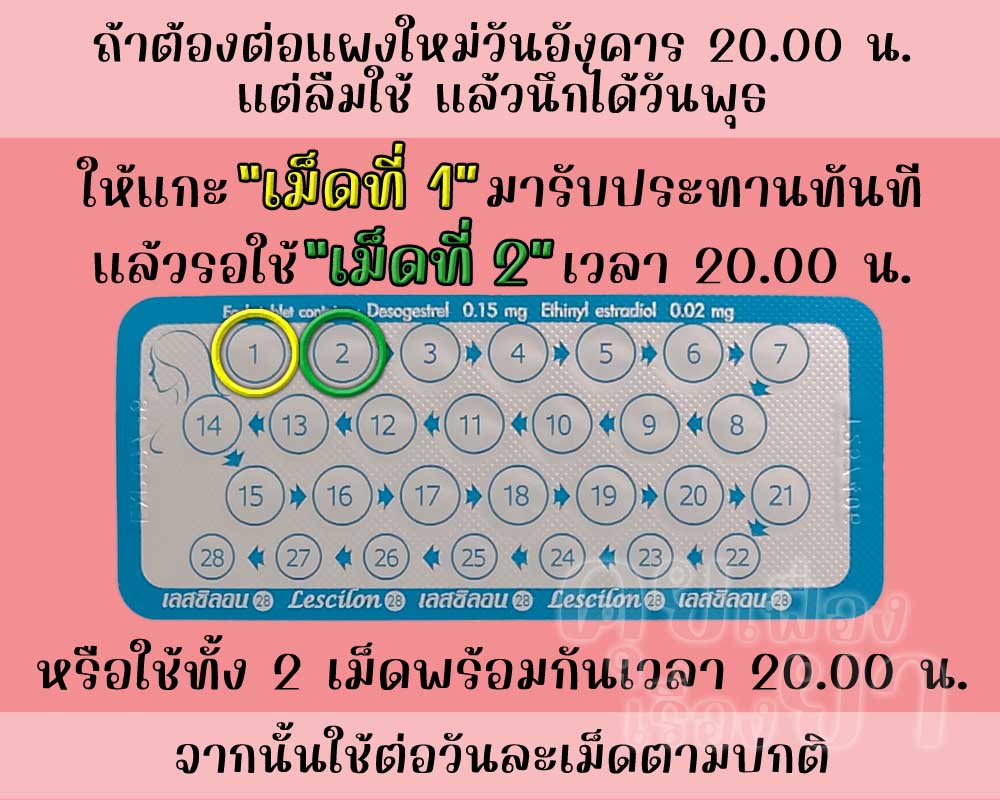 ลืมต่อแผงใหม่ยาคุม เลสซิลอน 28 จำนวน 1 วัน