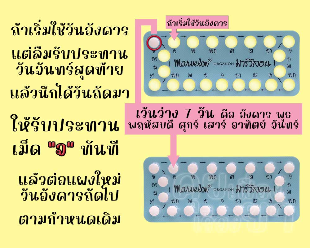 ลืมใช้ยาคุมเม็ดสุดท้ายในแผงของ มาร์วีลอน