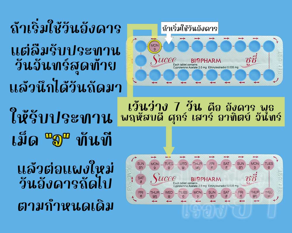 ลืมใช้ยาคุมเม็ดสุดท้ายในแผงของ ซูซี่