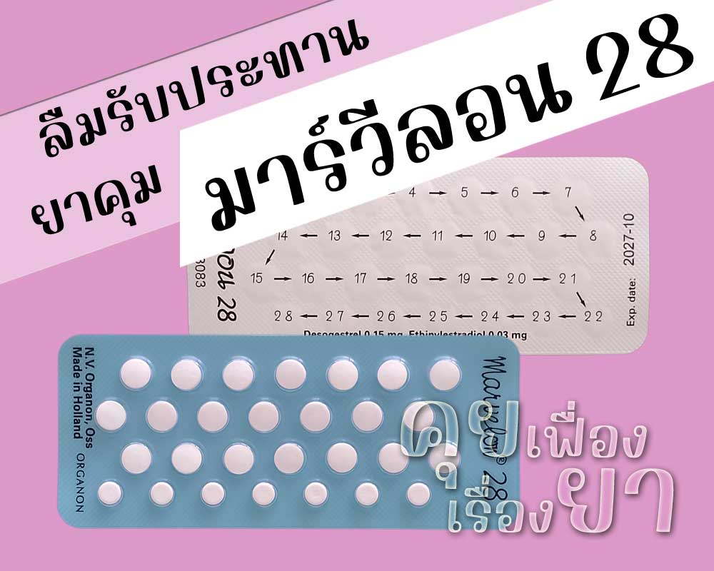 ลืมรับประทานยาคุม มาร์วีลอน 28