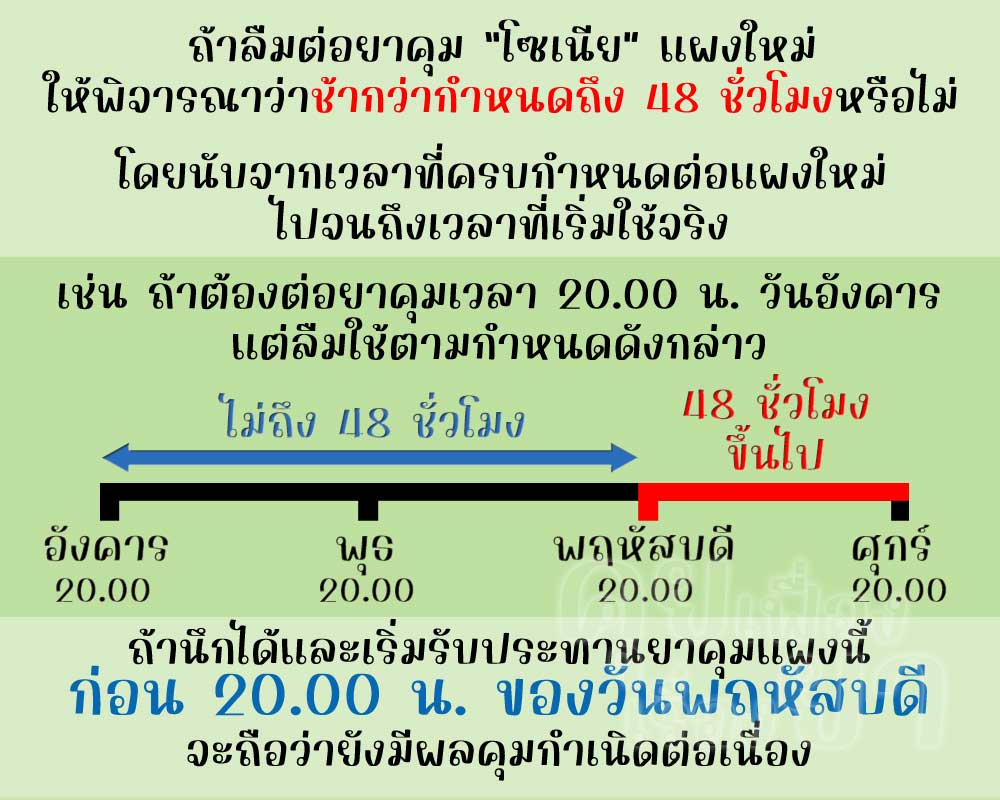 หากลืมต่อแผงใหม่ โซเนีย ตั้งแต่ 48 ชั่วโมงขึ้นไป จะไม่มีผลคุมกำเนิดแล้ว